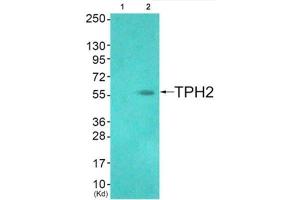 Western Blotting (WB) image for anti-Tryptophan Hydroxylase 2 (TPH2) (Ser19) antibody (ABIN1848390) (Tryptophan Hydroxylase 2 Antikörper  (Ser19))