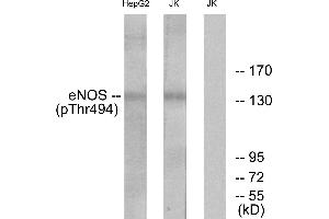 Western blot analysis of extracts from Jurkat cells and HepG2 cells, using eNOS (Phospho-Thr494) antibody. (ENOS Antikörper  (pThr494))