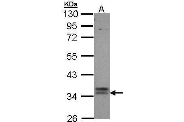 GPBAR1 Antikörper  (C-Term)