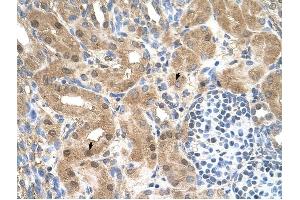 MGC39633 antibody was used for immunohistochemistry at a concentration of 4-8 ug/ml to stain Epithelial cells of renal tubule (arrows) in Human Kidney. (MGC39633 (N-Term) Antikörper)