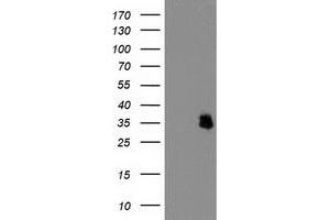 HEK293T cells were transfected with the pCMV6-ENTRY control (Left lane) or pCMV6-ENTRY IFI35 (Right lane) cDNA for 48 hrs and lysed. (IFI35 Antikörper)