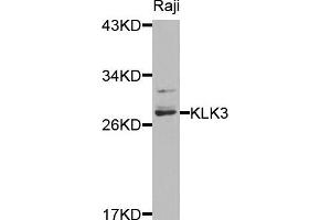 Western blot analysis of extracts of raji cells, using KLK3 antibody. (Prostate Specific Antigen Antikörper)