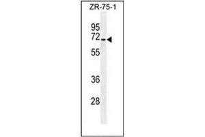Western blot analysis of HAUS3 Antibody (Center) in ZR-75-1 cell line lysates (35ug/lane). (HAUS3 Antikörper  (Middle Region))
