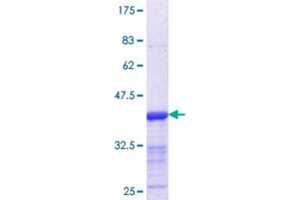 HOXB9 Protein (AA 1-98) (GST tag)