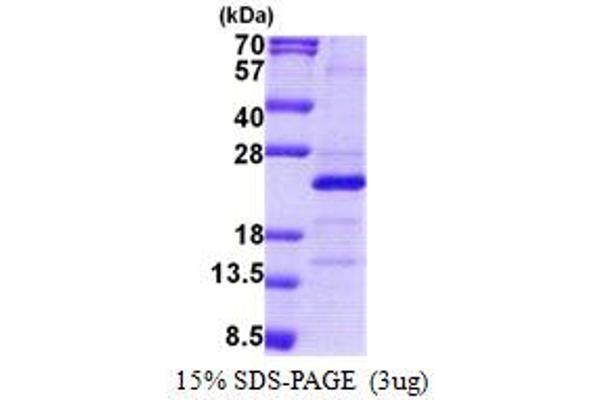 MRPS25 Protein (AA 1-173) (His tag)