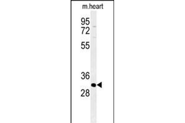 ATP4b Antikörper  (N-Term)