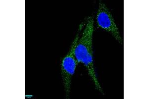 Immunofluorescence (IF) image for anti-Melanoma Cell Adhesion Molecule (MCAM) antibody (ABIN7127274)