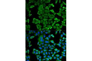 Immunofluorescence (IF) image for anti-Glyceraldehyde-3-Phosphate Dehydrogenase (GAPDH) (AA 1-335) antibody (ABIN3020538)