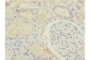 Immunohistochemistry of paraffin-embedded human kidney tissue using ABIN7159124 at dilution of 1:100 (MED22 Antikörper  (AA 2-140))