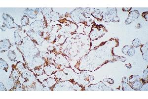 Human placenta: immunohistochemical staining for Vascular Endothelial Growth Factor Receptor-3: clone KLT9 (FLT4 Antikörper)