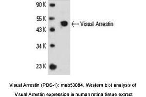 Image no. 1 for anti-S-Antigen, Retina and Pineal Gland (Arrestin) (SAG) antibody (ABIN363238) (SAG Antikörper)