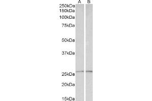 ABIN4902733 (0. (Peroxiredoxin 6 Antikörper)