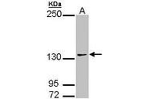 Image no. 2 for anti-Autism Susceptibility Candidate 2 (AUTS2) (AA 524-770) antibody (ABIN467523) (AUTS2 Antikörper  (AA 524-770))