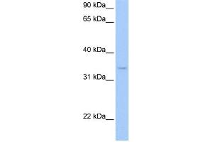 PDXK antibody used at 1 ug/ml to detect target protein. (PDXK Antikörper)