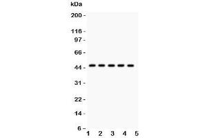 Western blot testing of PIM-1 antibody and human samples 1:  U20S;  2: A549;  3: COLO320;  4: SW620;  5: Jurkat. (PIM1 Antikörper  (C-Term))