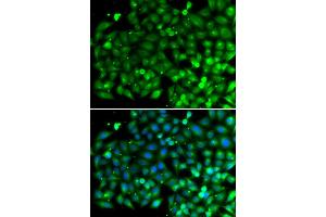 Immunofluorescence analysis of A549 cells using SH3GLB1 antibody. (SH3GLB1 Antikörper)