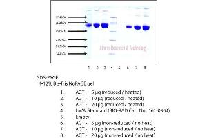 Gel Scan of Angiotensinogen, Human Plasma  This information is representative of the product ART prepares, but is not lot specific. (AGT Protein)