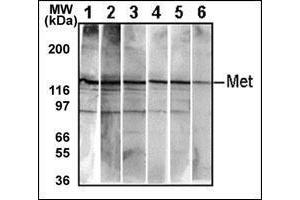 Western Blotting (WB) image for anti-Met Proto-Oncogene (MET) (Catalytic Domain) antibody (ABIN356340) (c-MET Antikörper  (Catalytic Domain))