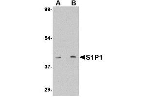 Image no. 1 for anti-Sphingosine-1-Phosphate Receptor 1 (S1PR1) (C-Term) antibody (ABIN342723) (S1PR1 Antikörper  (C-Term))