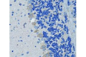 Immunohistochemistry of paraffin-embedded Mouse brain using Nestin Polyclonal Antibody at dilution of 1:100 (40x lens). (Nestin Antikörper)