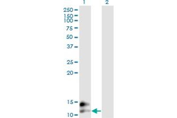 Osteocalcin Antikörper  (AA 52-100)