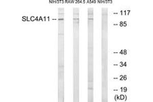 Western blot analysis of extracts from NIH-3T3/RAW264. (SLC4A11 Antikörper  (AA 291-340))