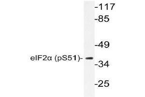 Western blot (WB) analyzes of p-eIF2alpha antibody in extracts from Jurkat insulin cells. (EIF2S1 Antikörper  (pSer51))