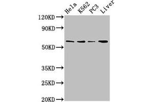 Western Blot Positive WB detected in: Hela whole cell lysate, K562 whole cell lysate, PC-3 whole cell lysate, Mouse liver tissue All lanes: RORA antibody at 2. (RORA Antikörper  (AA 110-214))