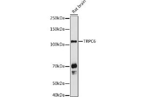 Western blot analysis of extracts of Rat brain, using TRPC6 antibody (ABIN6133946, ABIN6149580, ABIN6149581 and ABIN6224178) at 1:1000 dilution. (TRPC6 Antikörper  (AA 500-600))