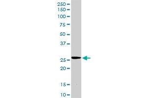 TIMP2 MaxPab rabbit polyclonal antibody. (TIMP2 Antikörper  (AA 1-220))