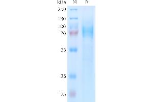 Human AD Protein, His Tag on SDS-PAGE under reducing condition. (ADGRE5 (AA 21-552) protein (His tag))