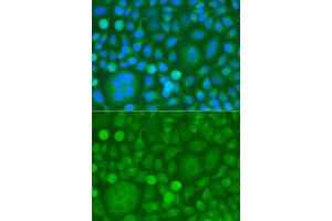Immunofluorescence analysis of HeLa cells using EPM2A antibody. (EPM2A Antikörper)