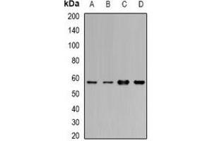 Western blot analysis of Cytochrome P450 1A1 expression in MCF7 (A), BT474 (B), mouse lung (C), mouse liver (D) whole cell lysates. (CYP1A1 Antikörper)