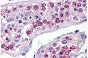 Human Testis (formalin-fixed, paraffin-embedded) stained with ATG16L1 antibody ABIN351446 at 5 ug/ml followed by biotinylated goat anti-rabbit IgG secondary antibody ABIN481713, alkaline phosphatase-streptavidin and chromogen. (ATG16L1 Antikörper  (N-Term))