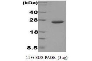 Figure annotation denotes ug of protein loaded and % gel used. (DsbC Protein)