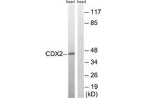 Western blot analysis of extracts from rat heart, using CDX2 (Ab-283) Antibody. (CDX2 Antikörper  (AA 249-298))