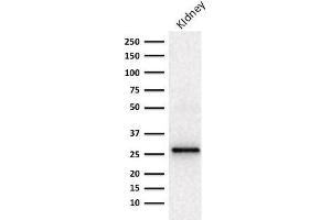 Western blot Analysis of human Kidney lysate using Adiponectin Mouse Monoclonal Antibody (ADPN/1370). (ADIPOQ Antikörper  (AA 145-226))