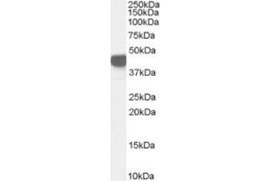 Western Blotting (WB) image for anti-Argininosuccinate Synthase 1 (ASS1) (Internal Region) antibody (ABIN2466477) (ASS1 Antikörper  (Internal Region))