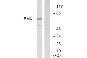 Western Blotting (WB) image for anti-BMX Non-Receptor Tyrosine Kinase (BMX) (N-Term) antibody (ABIN1849423) (BMX Antikörper  (N-Term))