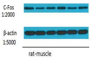 Western Blot (WB) analysis: Please contact us for more details. (c-FOS Antikörper)