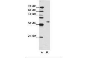 Image no. 2 for anti-Adenosine Deaminase, tRNA-Specific 1 (ADAT1) (AA 390-439) antibody (ABIN203068) (ADAT1 Antikörper  (AA 390-439))