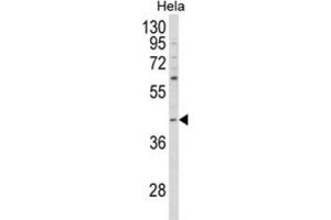 Western Blotting (WB) image for anti-NCK Adaptor Protein 1 (NCK1) antibody (ABIN3003930) (NCK1 Antikörper)