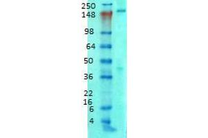 Western Blotting rat brain membrane 1 in 1000 AnkyrinB. (ANK2 Antikörper  (AA 203-496))