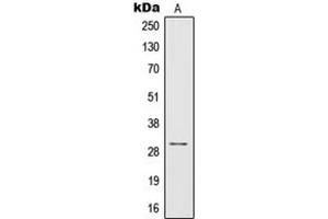 Western blot analysis of IL-1 beta expression in THP1 (A) whole cell lysates. (IL-1 beta Antikörper  (Center))