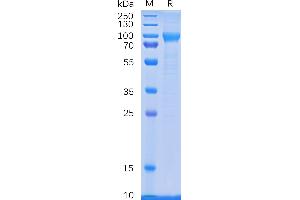 CSF3R Protein (AA 25-622) (His tag)