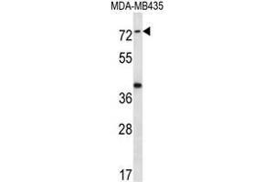 SYTL1 Antibody (Center) western blot analysis in MDA-MB435 cell line lysates (35 µg/lane). (SYTL1 Antikörper  (Middle Region))