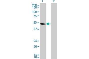 Western Blotting (WB) image for SH2D2A 293T Cell Transient Overexpression Lysate(Denatured) (ABIN1334373)