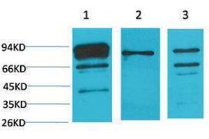 Western Blotting (WB) image for anti-Calnexin (CANX) antibody (ABIN3181566) (Calnexin Antikörper)