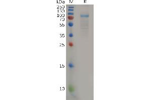 Human IL11RA Protein, hFc Tag on SDS-PAGE under reducing condition. (IL11RA Protein (AA 24-370) (Fc Tag))