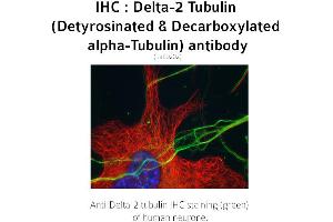 Image no. 1 for anti-Tubulin delta 2 (C-Term) antibody (ABIN489937) (Tubulin delta 2 (C-Term) Antikörper)